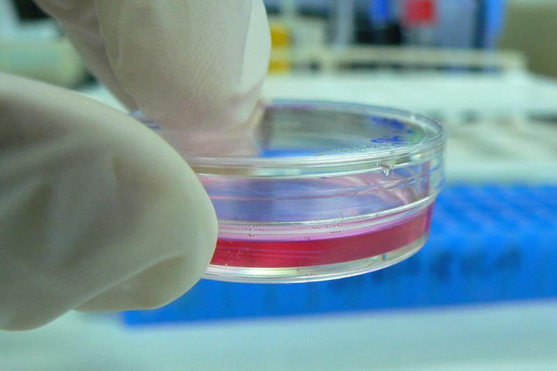 Hand in weißem Laborhandschuh hält Petrischale mit roter Flüssigkeit.